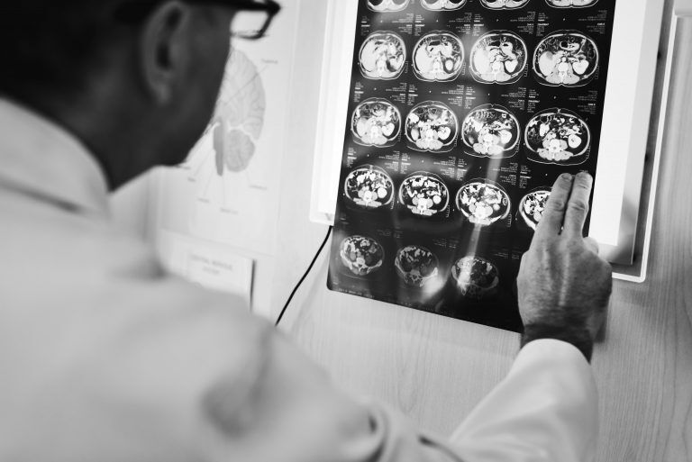 NYC brain injury lawyers